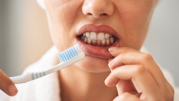 Will My Teeth Fall Out From Gum Disease
