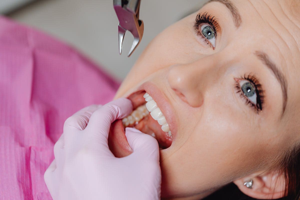How to Sleep After Wisdom Teeth Removal