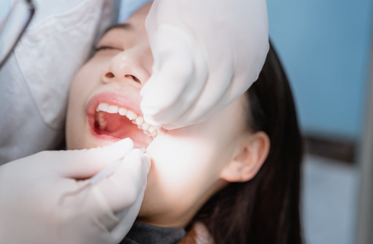 Can You Be Awake During Wisdom Teeth Removal