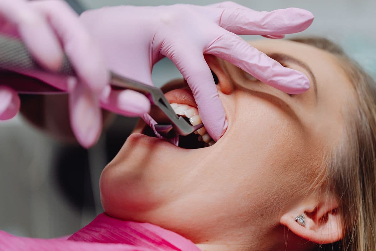 Tooth Extraction Complications Years Later